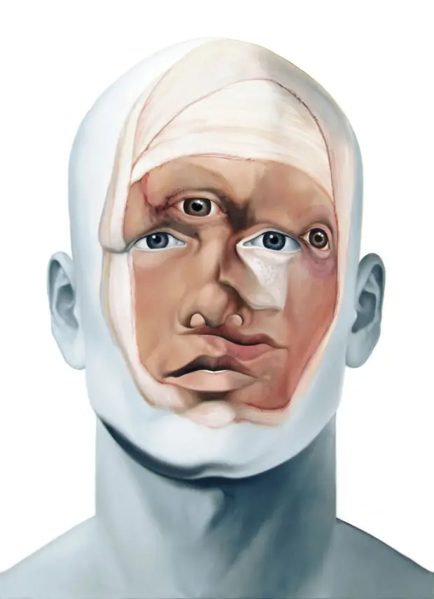 My New Surgery